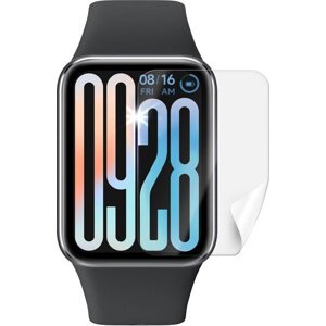 Screenshield XIAOMI Smart Band 9 Pro